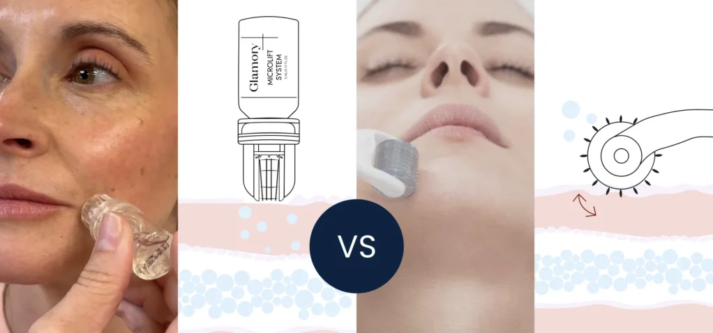 Glamory review showing MicroLift system and before and after skincare results